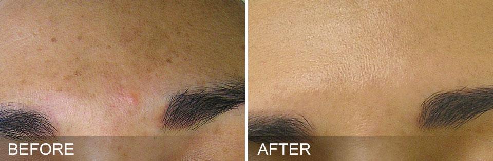 Healthylooks Med Spa & Wellness result — Lee's Summit, MO