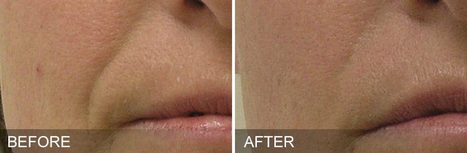 Healthylooks Med Spa & Wellness result — Lee's Summit, MO