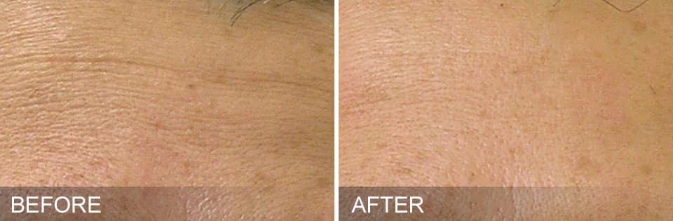 Healthylooks Med Spa & Wellness result — Lee's Summit, MO