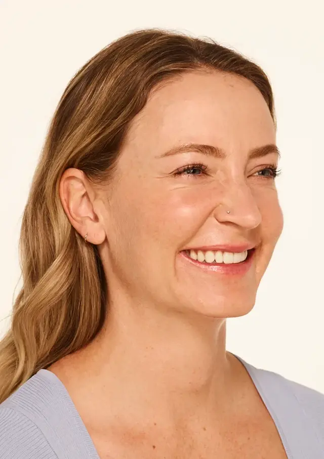 Botox before at Miami Skin Spa Aesthetics & Wellness in Miami, FL