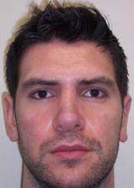 Providence Facial Plastic and Cosmetic Surgery rhinoplasty after — Concordville, PA