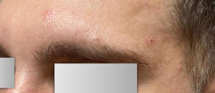 Beverly Hills Aesthetics result — Los Angeles, CA