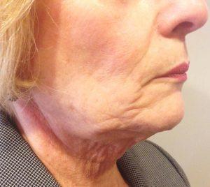 Beverly Hills Aesthetics provider photo