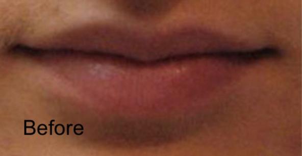 Beverly Hills Aesthetics result — Los Angeles, CA