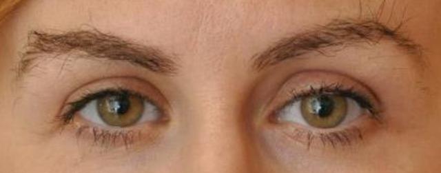Beverly Hills Aesthetics provider photo