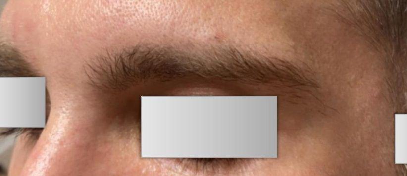 Beverly Hills Aesthetics result — Los Angeles, CA