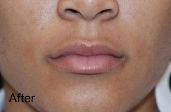 Beverly Hills Aesthetics provider photo