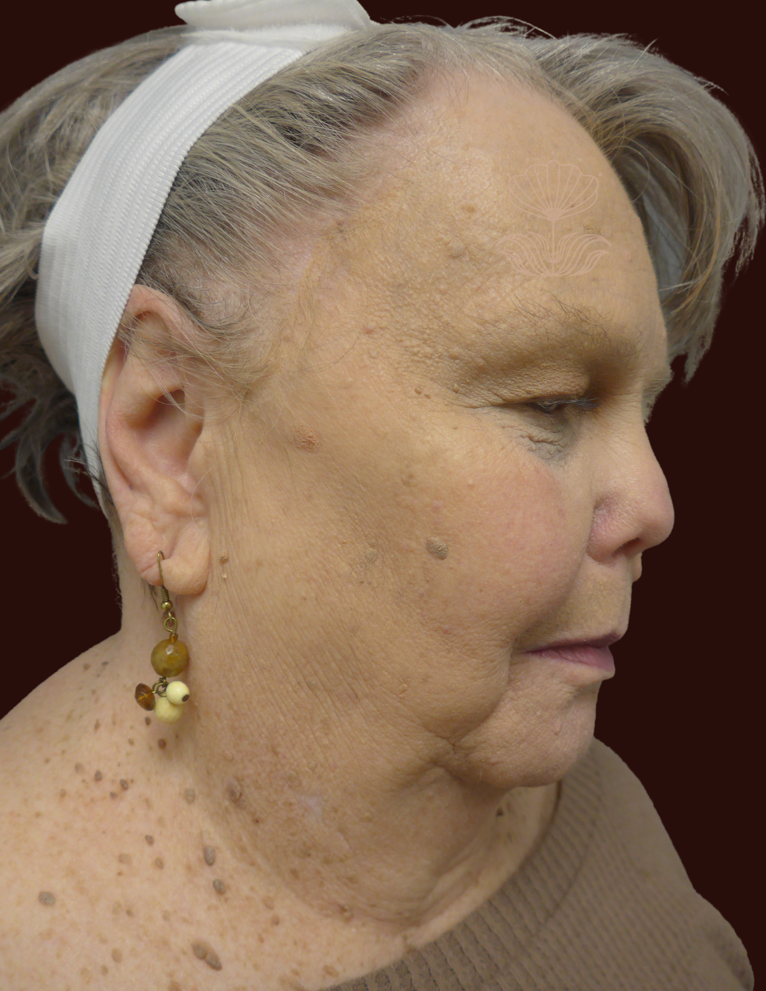 Suma Maddox, MD after — New Orleans, LA