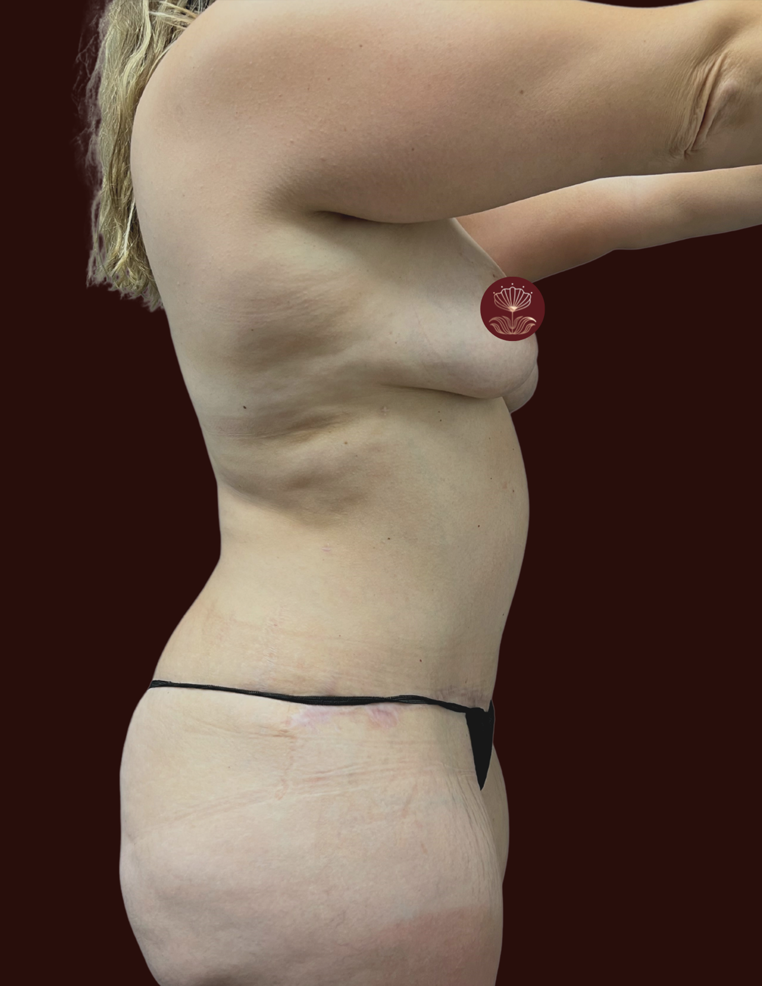 Suma Maddox, MD after — New Orleans, LA