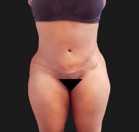 Aristocrat Plastic Surgery: Dr. Kevin Tehrani - NYC provider photo