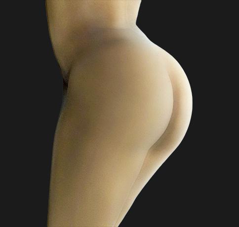 Aristocrat Plastic Surgery: Dr. Kevin Tehrani - NYC bbl after — New York, NY