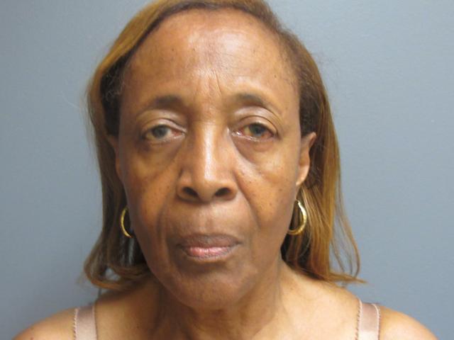Brow Lift before at Aesthetic Plastic Surgery & Laser Center, Michelle Hardaway M.D. in Farmington Hills, MI