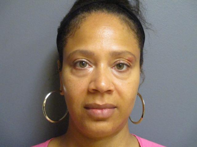 Blepharoplasty before at Aesthetic Plastic Surgery & Laser Center, Michelle Hardaway M.D. in Farmington Hills, MI