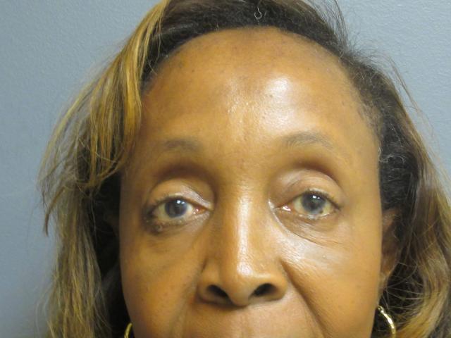 Brow Lift after at Aesthetic Plastic Surgery & Laser Center, Michelle Hardaway M.D. in Farmington Hills, MI