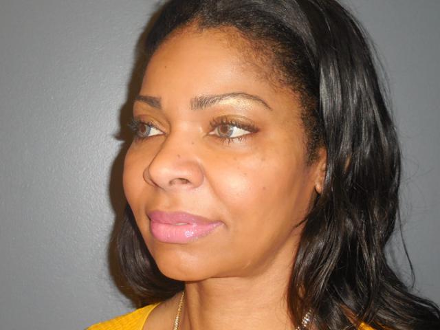 Aesthetic Plastic Surgery & Laser Center, Michelle Hardaway M.D. provider photo