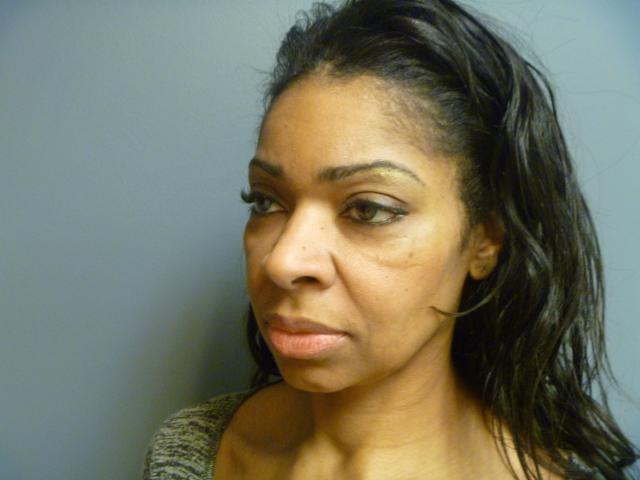 Fat Transfer before at Aesthetic Plastic Surgery & Laser Center, Michelle Hardaway M.D. in Farmington Hills, MI