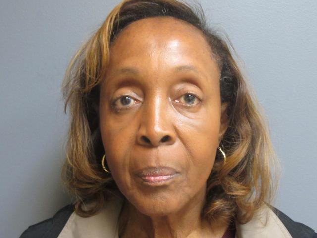 Brow Lift after at Aesthetic Plastic Surgery & Laser Center, Michelle Hardaway M.D. in Farmington Hills, MI