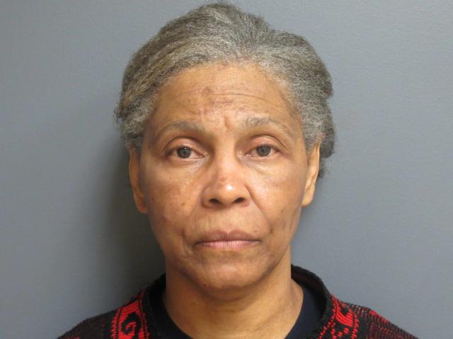Chemical Peel before at Aesthetic Plastic Surgery & Laser Center, Michelle Hardaway M.D. in Farmington Hills, MI
