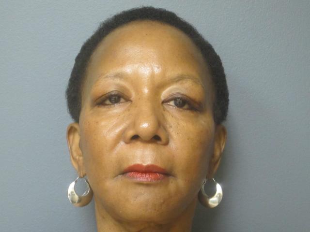 Mini Facelift after at Aesthetic Plastic Surgery & Laser Center, Michelle Hardaway M.D. in Farmington Hills, MI