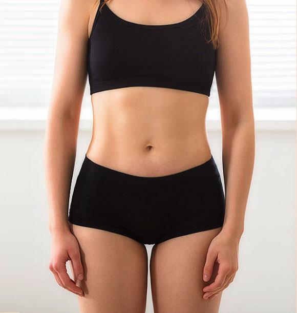 Aesthetic Plastic Surgery & Laser Center, Michelle Hardaway M.D. body contouring after — Farmington Hills, MI