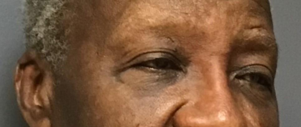 Aesthetic Plastic Surgery & Laser Center, Michelle Hardaway M.D. body contouring result — Farmington Hills, MI