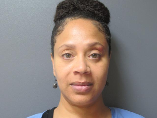 Blepharoplasty after at Aesthetic Plastic Surgery & Laser Center, Michelle Hardaway M.D. in Farmington Hills, MI