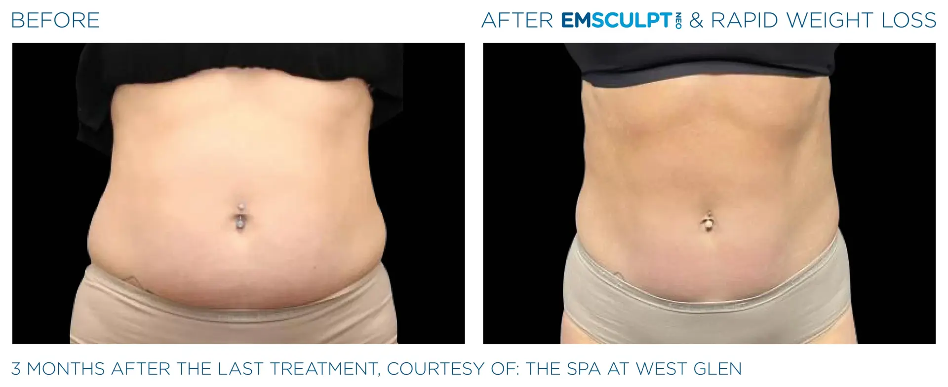 Montrose Med Spa result — Houston, TX