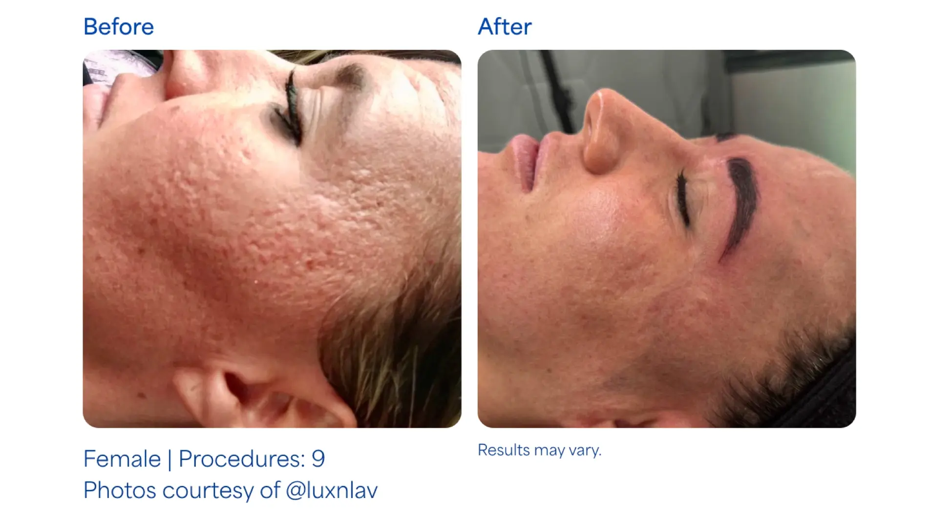 Montrose Med Spa result — Houston, TX