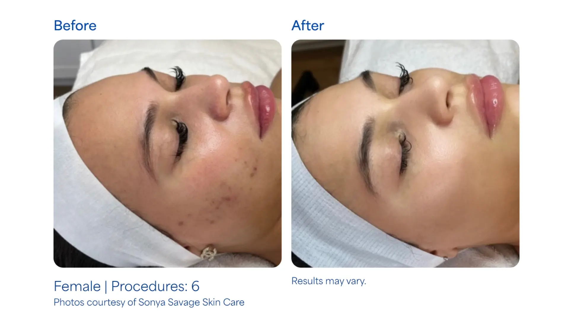 Montrose Med Spa result — Houston, TX