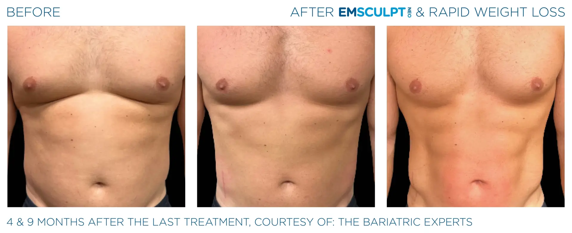 Montrose Med Spa result — Houston, TX