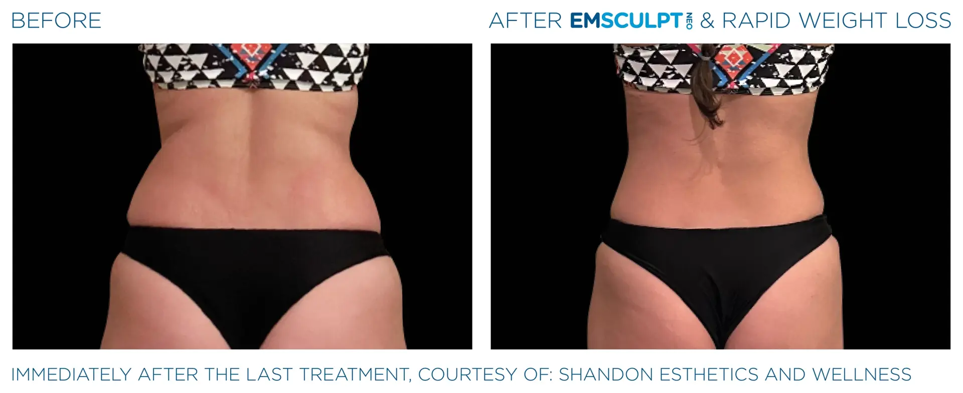 Montrose Med Spa result — Houston, TX