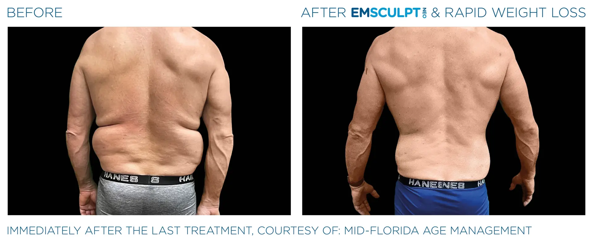 Montrose Med Spa result — Houston, TX