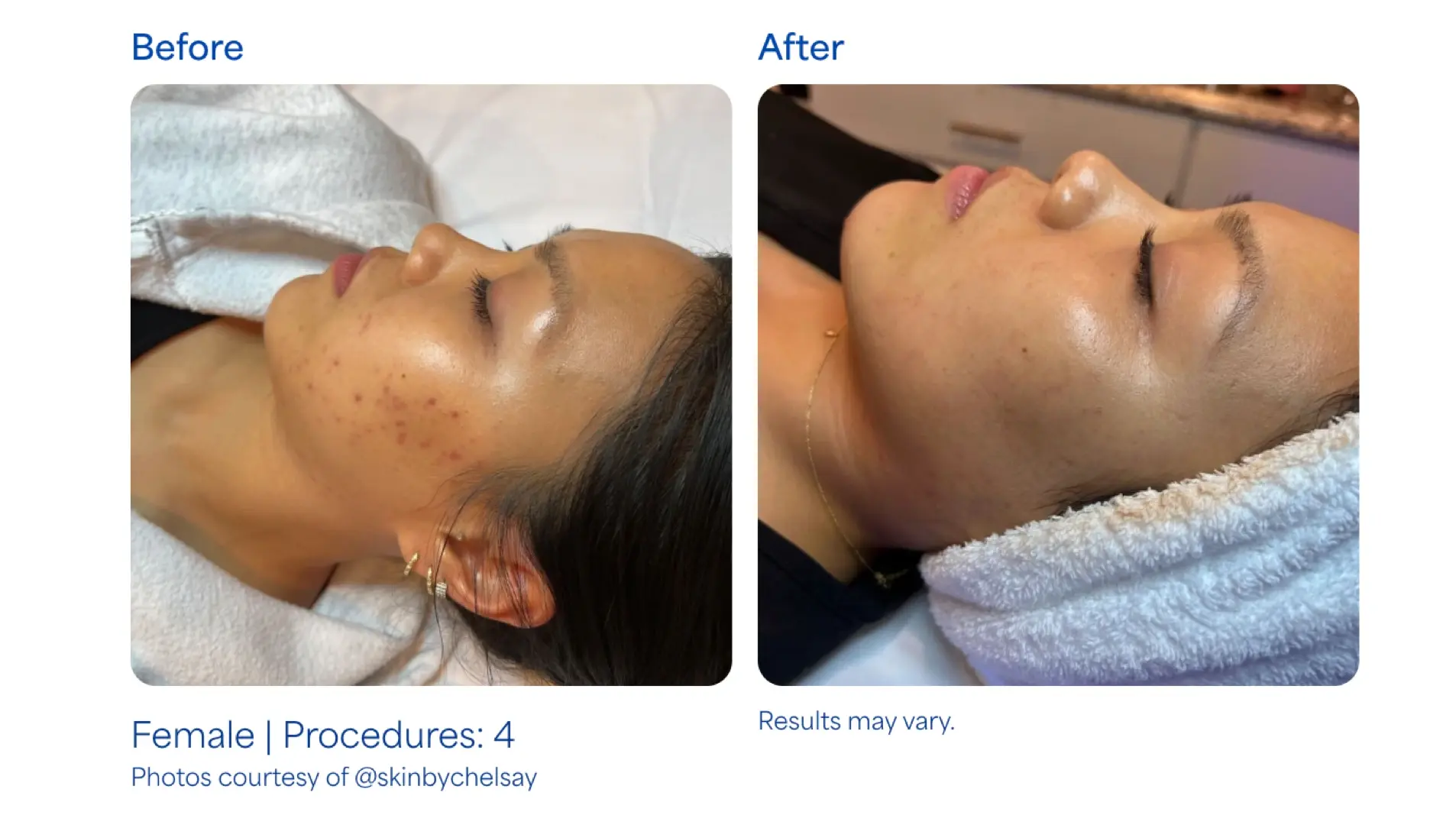 Montrose Med Spa result — Houston, TX