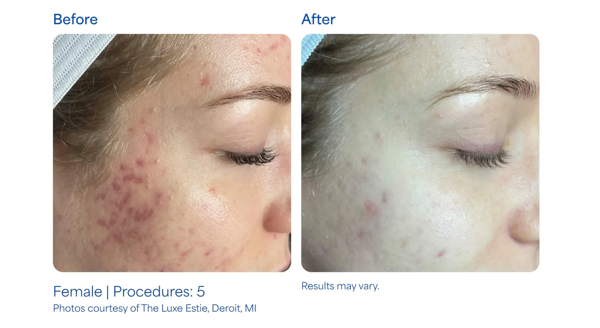 Montrose Med Spa result — Houston, TX