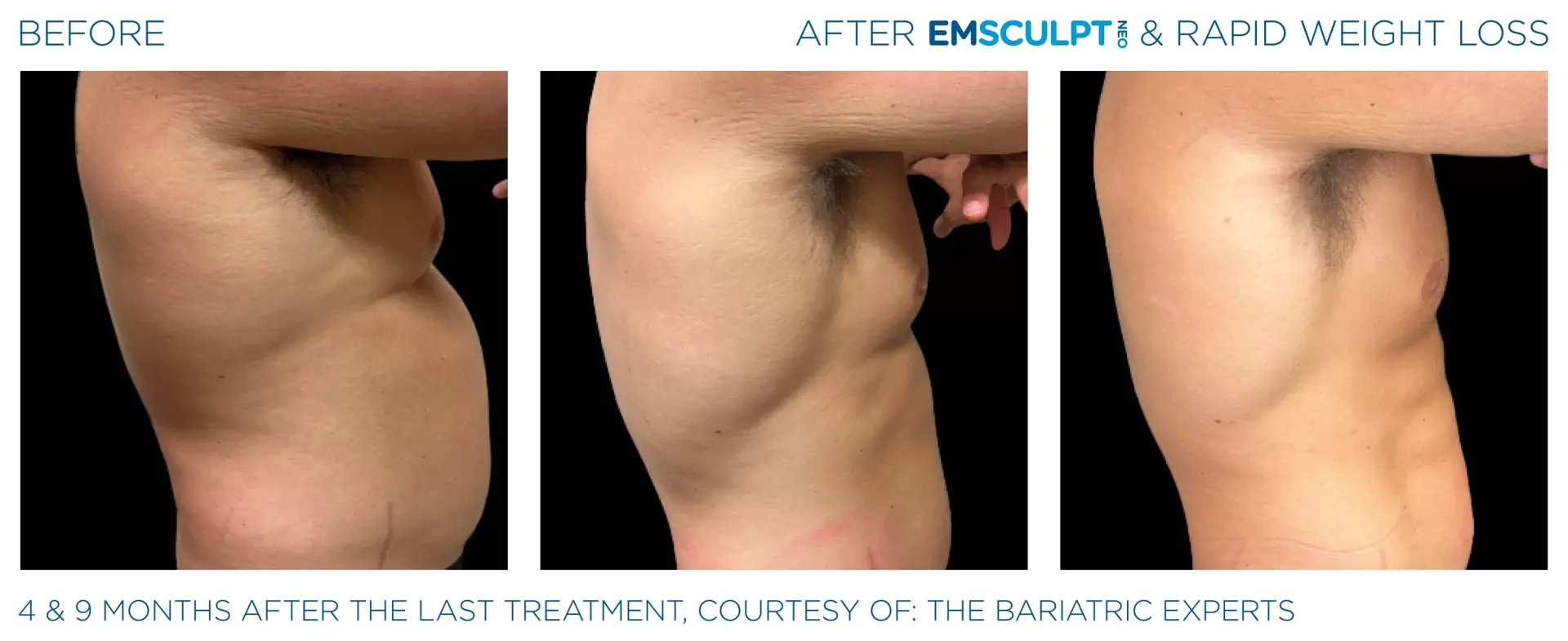 Montrose Med Spa result — Houston, TX