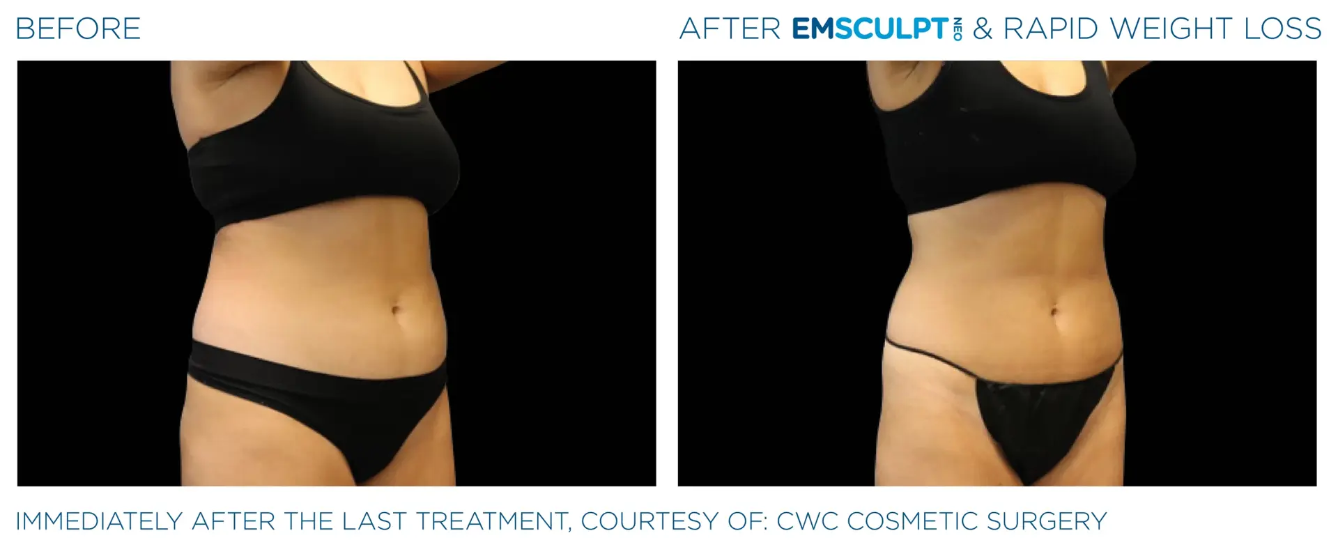 Montrose Med Spa result — Houston, TX