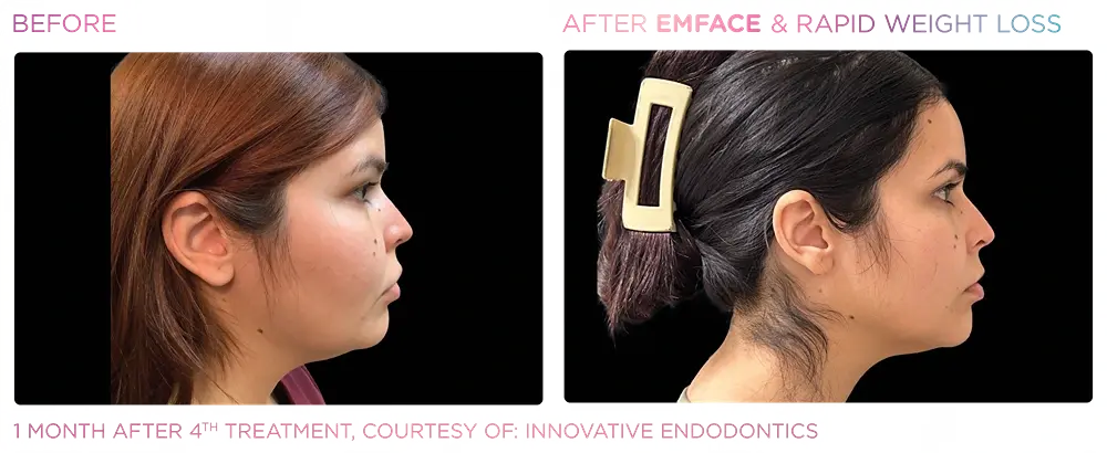 Montrose Med Spa result — Houston, TX