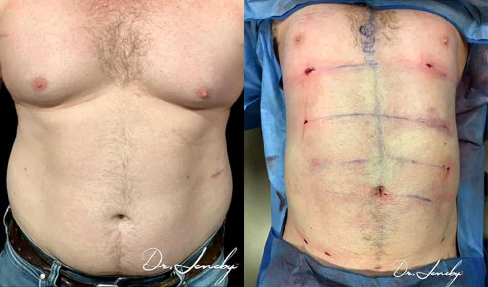 Dr. Jeneby Plastic Surgery result — San Antonio, TX
