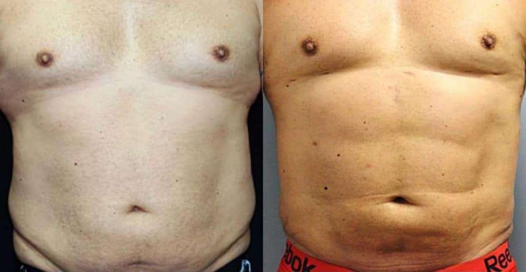 Dr. Jeneby Plastic Surgery result — San Antonio, TX