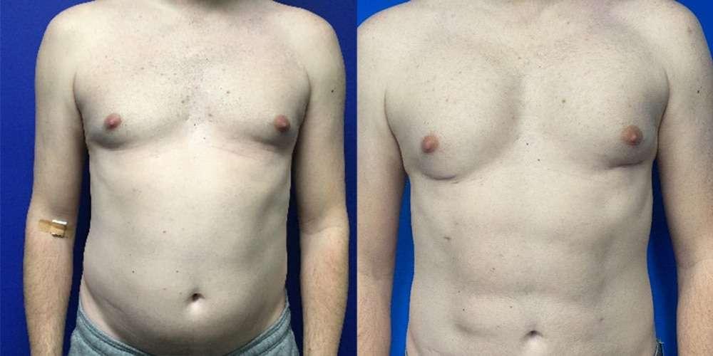 Dr. Jeneby Plastic Surgery result — San Antonio, TX