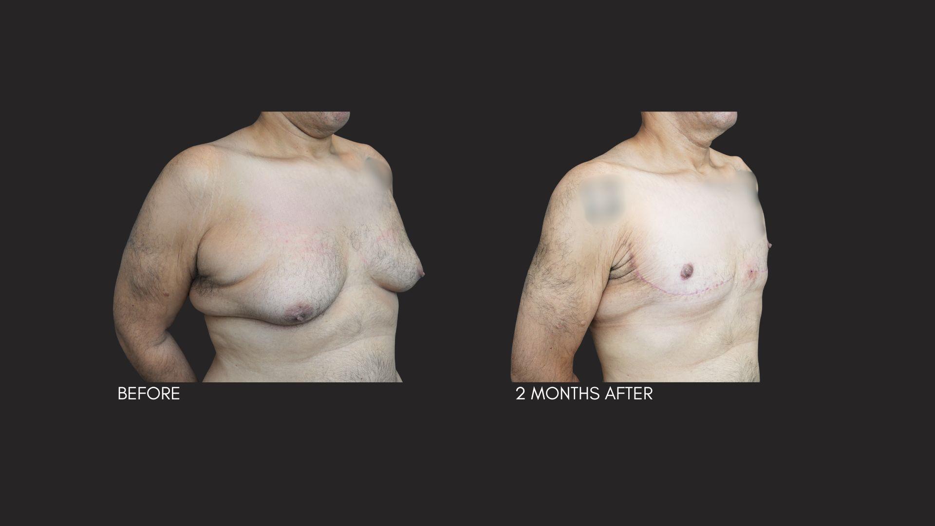 Itay Wiser MD result — New York, NY