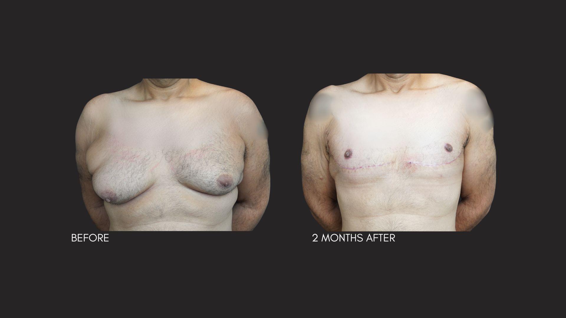 Itay Wiser MD result — New York, NY