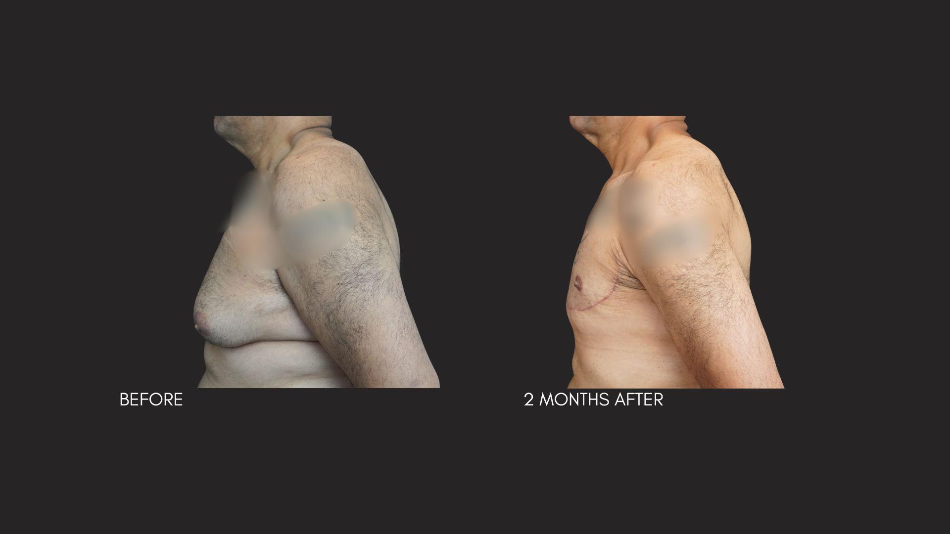 Itay Wiser MD result — New York, NY