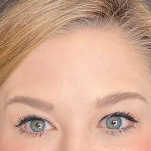 Botox after at Cosmetic Surgery Dallas in Dallas, TX