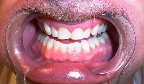 Dentistry of Old Town Scottsdale smile makeover after — Scottsdale, AZ