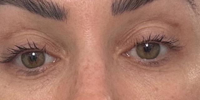 Jewell Aesthetics after — Dallas, TX