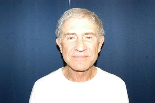 James Black, MD facelift after — Torrance, CA