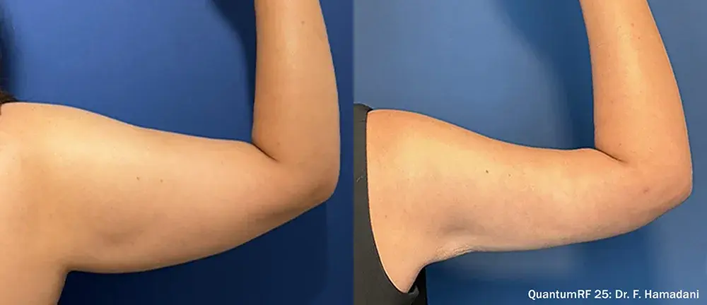 The Luxe Medspa Aesthetics & Bodycare result — Upper Arlington, OH