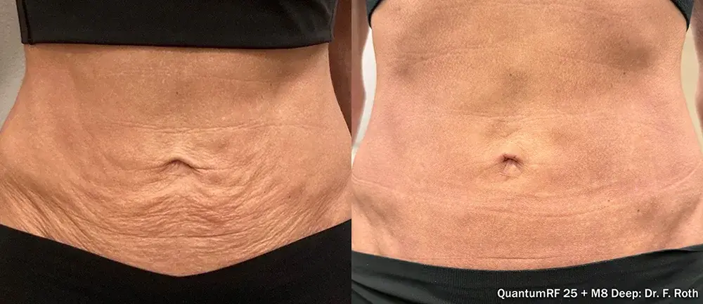 The Luxe Medspa Aesthetics & Bodycare result — Upper Arlington, OH