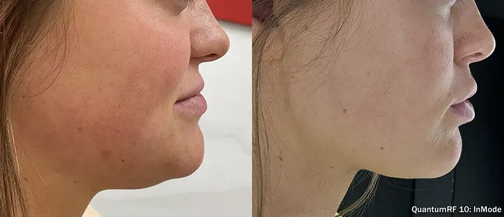 The Luxe Medspa Aesthetics & Bodycare result — Upper Arlington, OH
